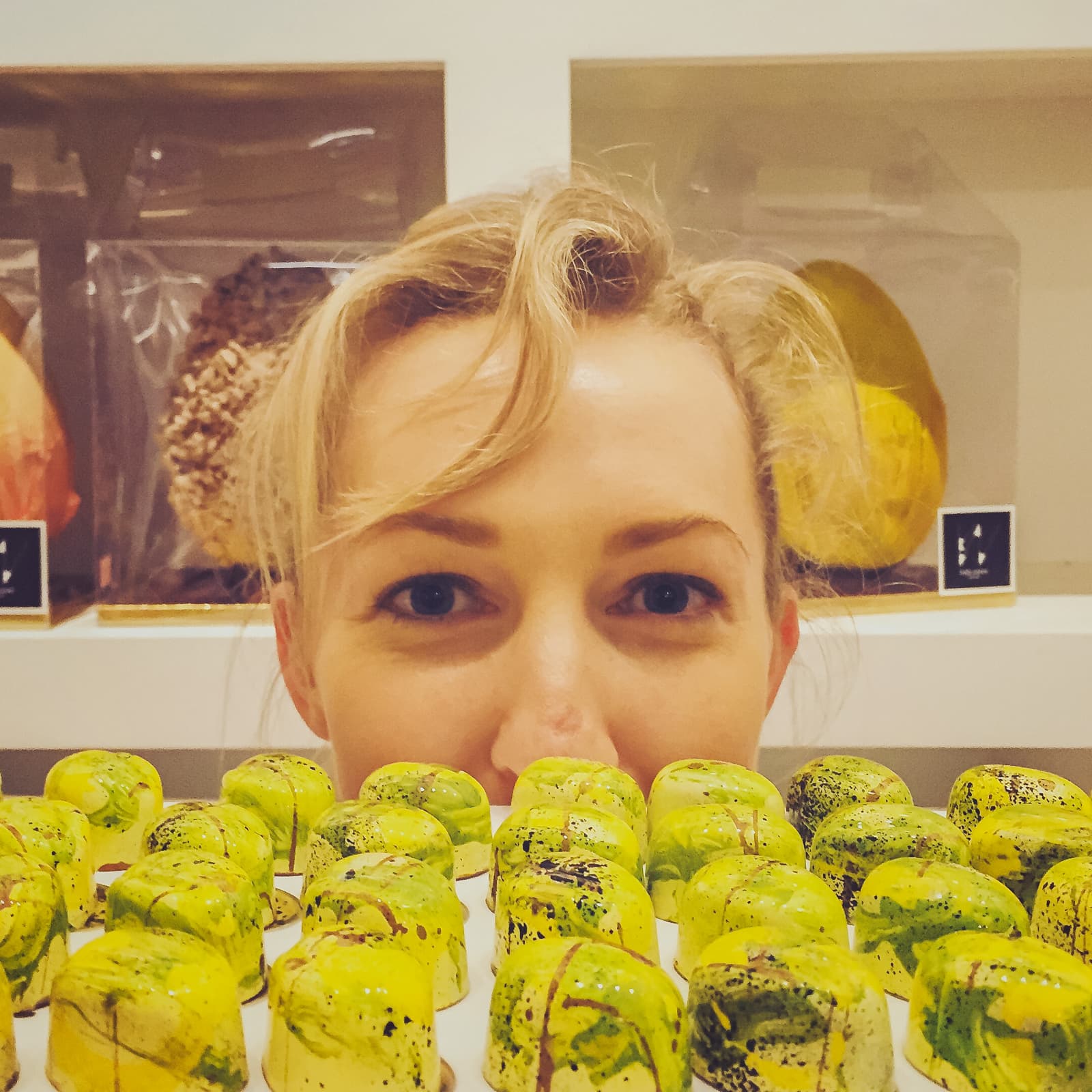 The Eyes Are A Window